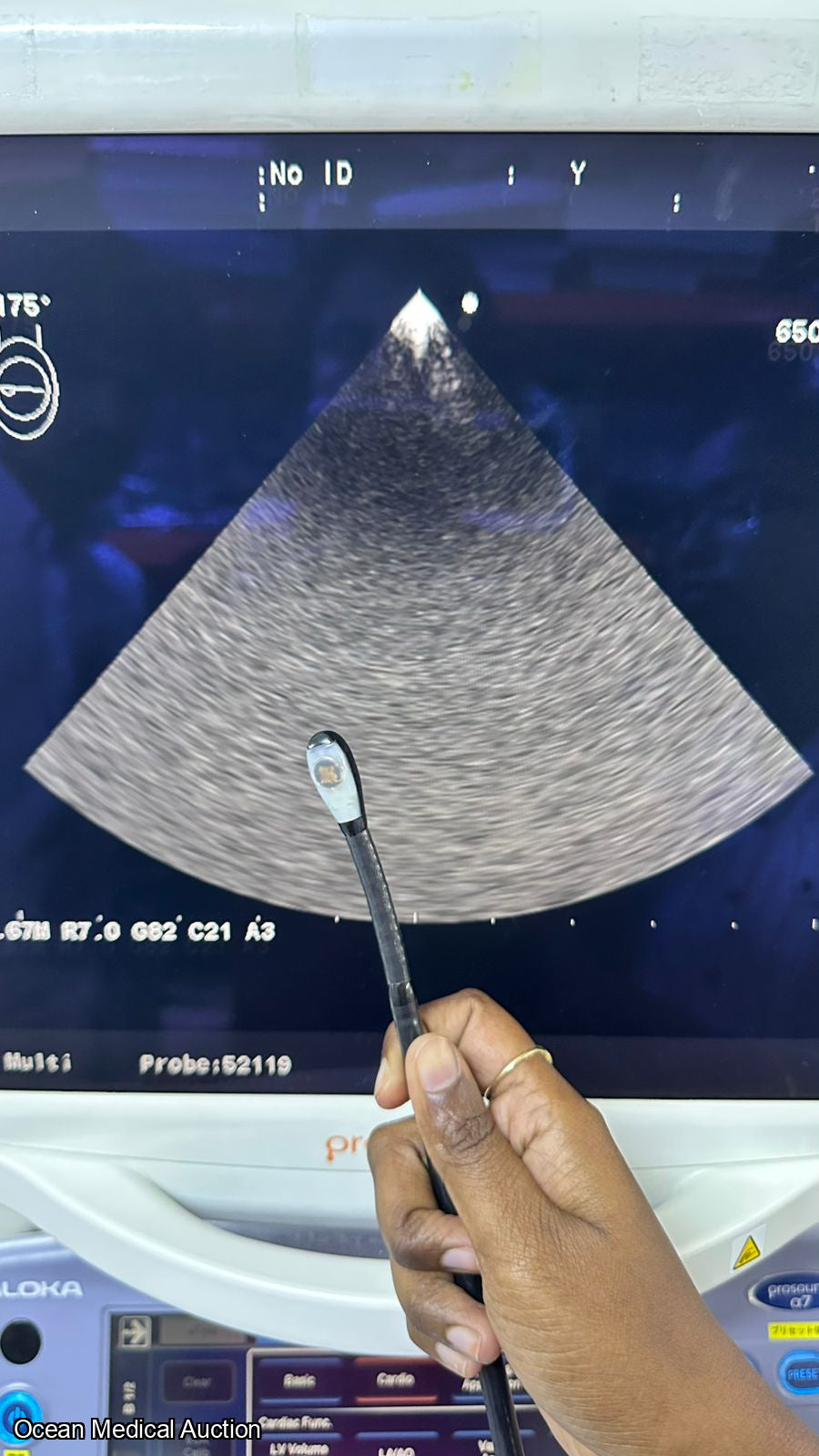 Aloka model ust -52119s sn.200A9387